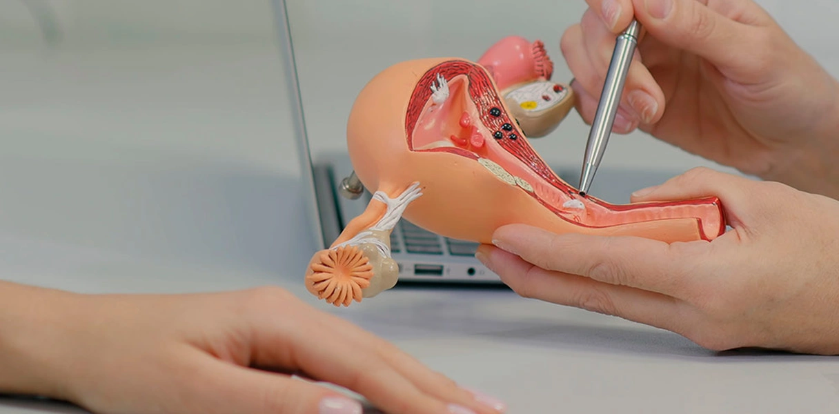 preparación endometrial, transferencia de embriones,  reproducción asistida, FIV Valencia, ciclo natural, ciclo artificial,  endometrio, preparación endometrial para FIV,  grosor endometrial,  receptividad endometrial,  ciclo sustituido,  ventajas ciclo n